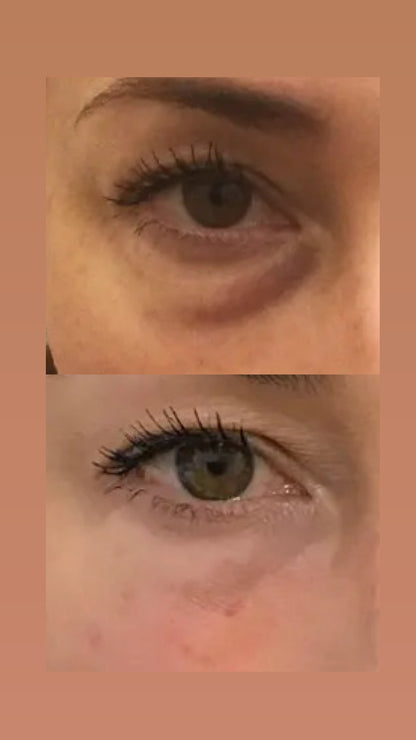 Retinol Eye Stick – סוד הקסם לעיניים צעירות וברק טבעי ✨ | מחליק קמטים | מעלים עיגולים כהים | מעניק לחות וזוהר