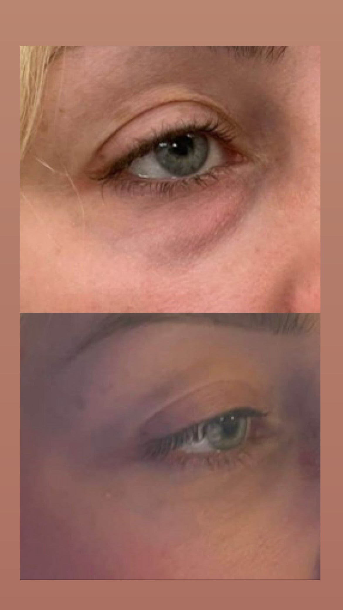 Retinol Eye Stick – סוד הקסם לעיניים צעירות וברק טבעי ✨ | מחליק קמטים | מעלים עיגולים כהים | מעניק לחות וזוהר