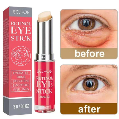 Retinol Eye Stick – סוד הקסם לעיניים צעירות וברק טבעי ✨ | מחליק קמטים | מעלים עיגולים כהים | מעניק לחות וזוהר