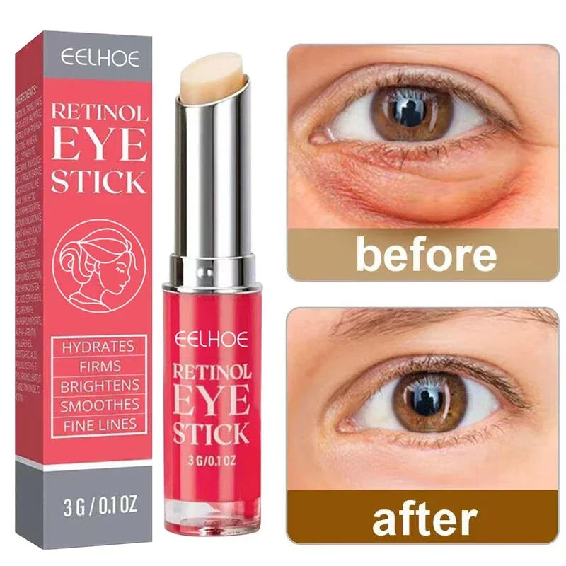 Retinol Eye Stick – סוד הקסם לעיניים צעירות וברק טבעי ✨ | מחליק קמטים | מעלים עיגולים כהים | מעניק לחות וזוהר